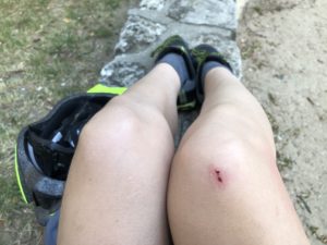 Genou égratiné, casque de vélo à côté